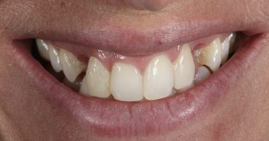 Before - Ringway Dental