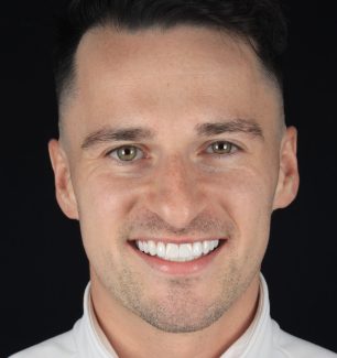 Face - Ringway Dental