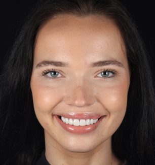 Face - Ringway Dental