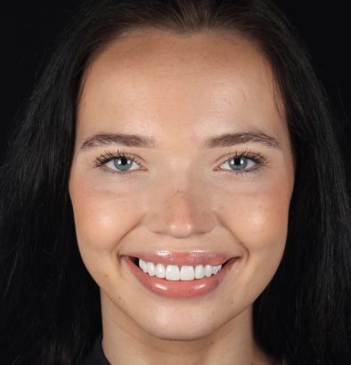 Face - Ringway Dental