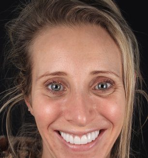 Face - Ringway Dental