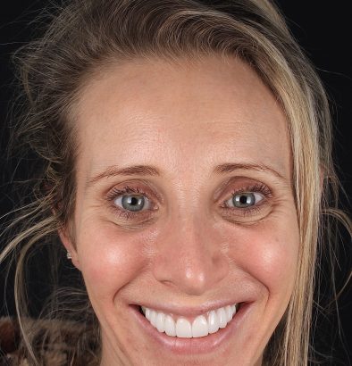 Face - Ringway Dental