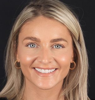 Face - Ringway Dental