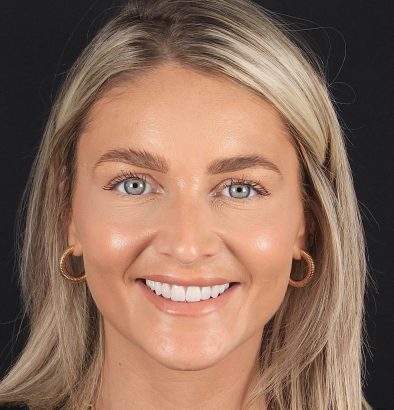 Face - Ringway Dental