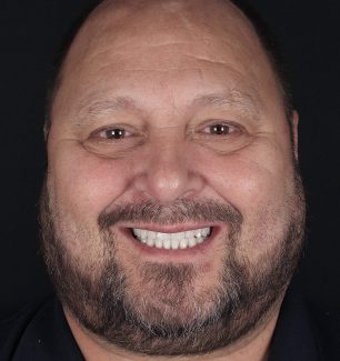 Face - Ringway Dental