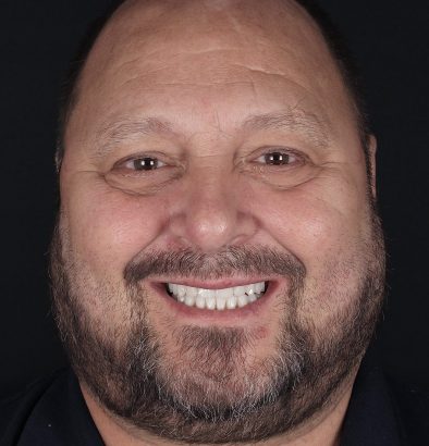 Face - Ringway Dental