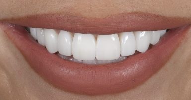 After - Ringway Dental