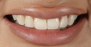 Before - Ringway Dental