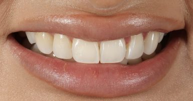 Before - Ringway Dental