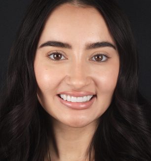 Face - Ringway Dental