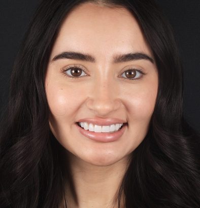 Face - Ringway Dental